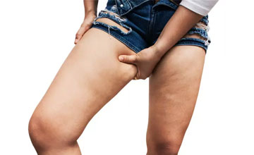 Толстые ноги у женщин как похудеть упражнения thumbnail